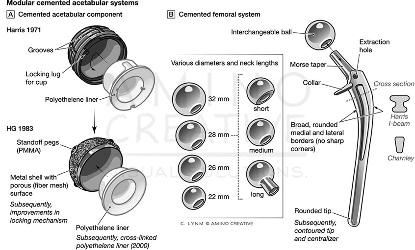 medical illustration of A series of illustrations for The Harris Orthopaedic Laboratory @ The Mass General by William H. Harris, MD.