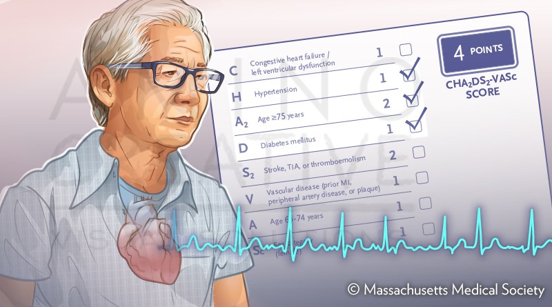medical illustration of Screening for Atrial Fibrillation in Asymptomatic Older Adults. N Engl J Med 2022; 387:565-567
DOI: 10.1056/NEJMclde2203726