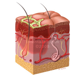 medical illustration of Part of series of illustrations on pesticides and the effect on the body.