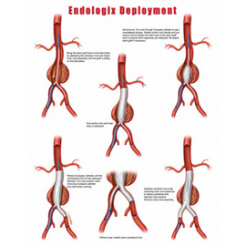 medical illustration of Color, General Surgery, Medical Devices, Vascular Surgery, Injuries, Legal Exhibits