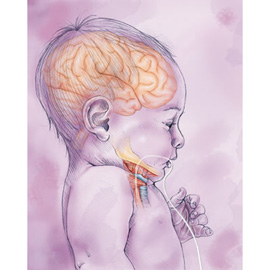 medical illustration of Airbrush, Color, Design, Line with Color, Anatomy, Biology, Medical Devices, Pediatrics