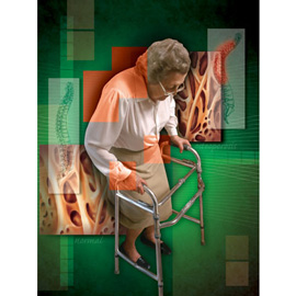 medical illustration of Airbrush, Color, Design, Photography, Anatomy, Biology, Genetics, Orthopaedics