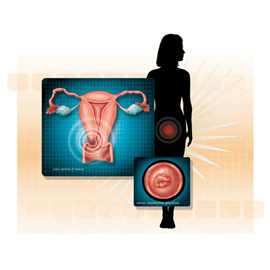 medical illustration of Airbrush, Color, Design, Anatomy, Biology, Disease Management, Obstetrics / Gynecology