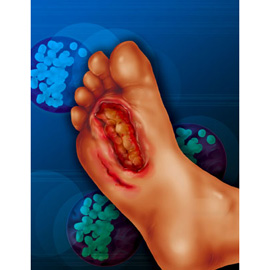 medical illustration of Color, Design, Anatomy, Cell biology / Histology, Dermatology, Disease Management, General Medicine