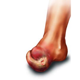 medical illustration of Airbrush, Color, Anatomy, Disease Management, General Medicine, Injuries