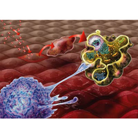 medical illustration of Apoptosis, or programmed cell death, is a fail-stop to keep unhealthy, sick cells from continuing to grow and multiply. Shown in this illustration is an unhealthy cell undergoing apoptosis, about to be 'cleaned-up' by a macrophage (white blood cell). When this system goes awry, cancer can develop.