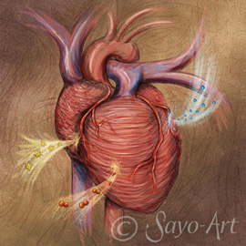 medical illustration of Many of the life-saving chemotherapies now available to combat cancer have negative side effects which can harm the heart.