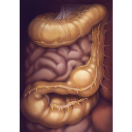 medical illustration of Color, Anatomy, Gastroenterology, General Medicine