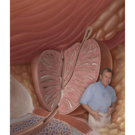 medical illustration of Color, General Medicine, Urology