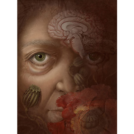 medical illustration of Color, General Medicine