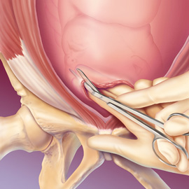medical illustration of Color, Maternal / Child, Obstetrics / Gynecology, Pediatrics