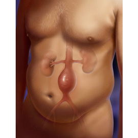 medical illustration of Anatomy, Emergency Medicine, General Medicine, General Surgery, Thoracic Surgery, Vascular Surgery