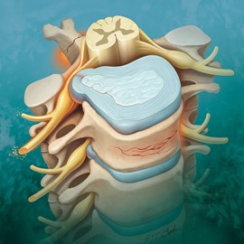medical illustration of Emergency Medicine, Neuroscience, Neurosurgery, Physical Therapy, Injuries, Legal Exhibits