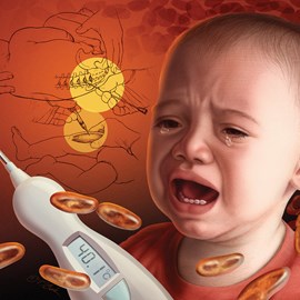 medical illustration of Color, Emergency Medicine, General Medicine, Maternal / Child, Pediatrics