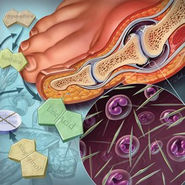 medical illustration of Color, Cell biology / Histology, Disease Management, General Medicine, Orthopaedics, Urology