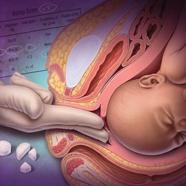 medical illustration of Color, Maternal / Child, Obstetrics / Gynecology, Reproductive Biology