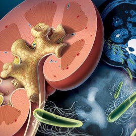 medical illustration of Color, Emergency Medicine, General Medicine, Urology