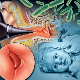 medical illustration of Color, General Medicine, Medical Devices, Pediatrics