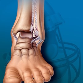 medical illustration of Color, Emergency Medicine, General Medicine, Orthopaedics, Physical Therapy