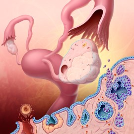 medical illustration of Color, Disease Management, Emergency Medicine, Obstetrics / Gynecology, Reproductive Biology