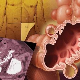 medical illustration of Disease Management, Emergency Medicine, Gastroenterology, General Medicine, General Surgery