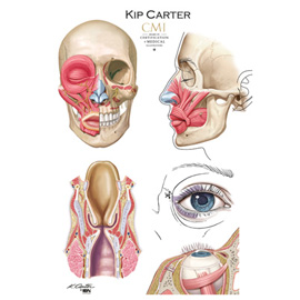 medical illustration of Airbrush, Color, Line with Color, Anatomy, General Surgery, Plastic & Reconstructive Surgery