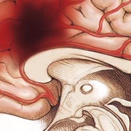 medical illustration of Brain showing distribution of the Cerebral arteries