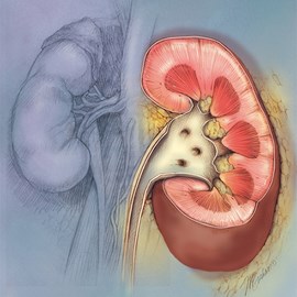 medical illustration of Color, Line with Color, Anatomy, Disease Management, Urology