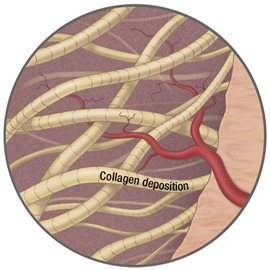 medical illustration of Color, Anatomy, Biotechnology, Cell biology / Histology, Disease Management, General Medicine, Pharmacology