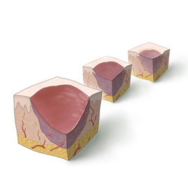 medical illustration of Color, Anatomy, Disease Management, General Medicine, Pharmacology, Injuries