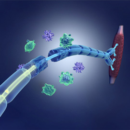 medical illustration of Color, Allergy / Immunology, Disease Management, Neuroscience