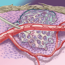 medical illustration of Color, Cell biology / Histology, General Medicine, General Surgery, Medical Devices