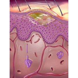 medical illustration of Allergy / Immunology, Dermatology, General Medicine