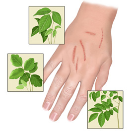 medical illustration of Color, Allergy / Immunology, Botany, Dermatology, General Medicine, Pharmacology