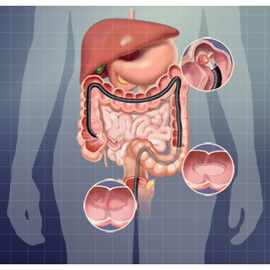 medical illustration of Gastroenterology, Pharmacology