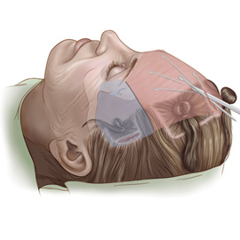 medical illustration of Airbrush, Color, General Surgery, Plastic & Reconstructive Surgery, Portraits