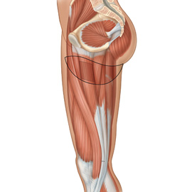 medical illustration of 