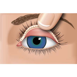 medical illustration of Anatomy, General Medicine, Ophthalmology