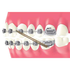 medical illustration of Anatomy, Dentistry