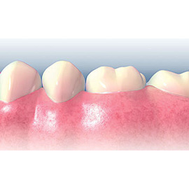 medical illustration of Color, Three-dimensional / Models, Anatomy, Dentistry