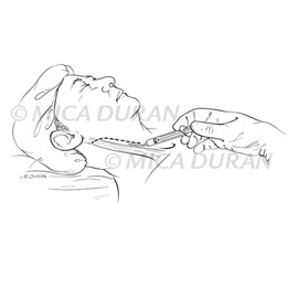 medical illustration of One in a series for Surgical Techniques Book