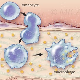 medical illustration of Part of  series of method of action graphics for pharmaceutical project