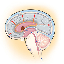 medical illustration of Information Graphics, Anatomy, Neuroscience, Neurosurgery