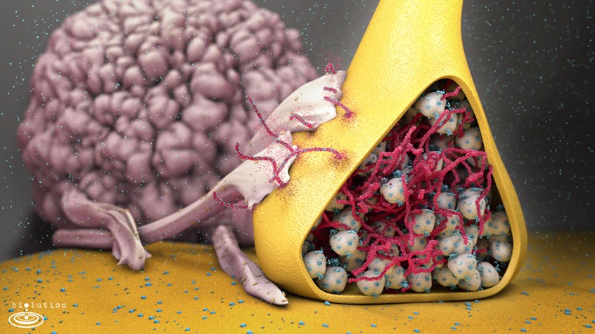 medical illustration of Wrongly folded Alpha-Synuclein similar to prions agglutinates, breaks through the cell wall and infects other neurons which results in the death of dopamine producing cells giving the starting shot to Parkinson’s Disease. In this picture, Macrophages attack the aggregates and stop further infection of healthy cells, because of a vaccination.
by biolution