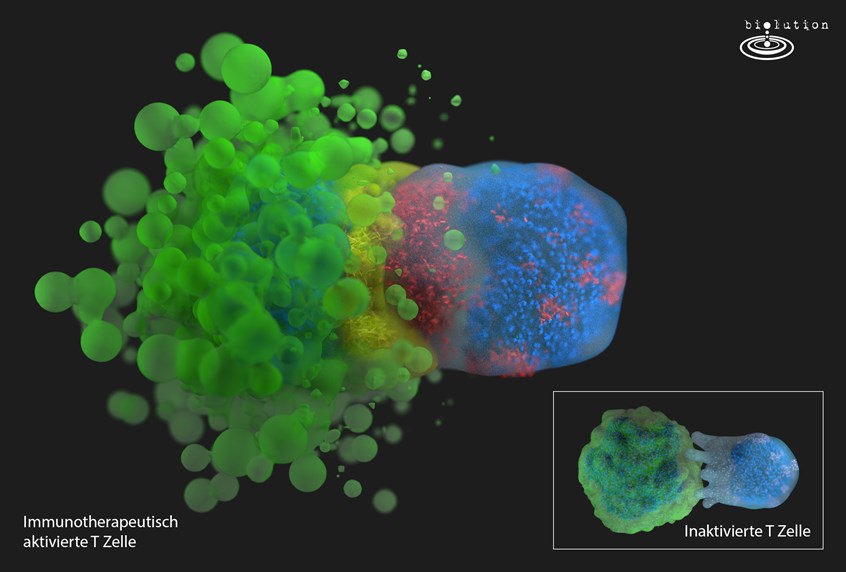 medical illustration of Cancer has found ways to hide from the immune system to escape death. But scientist found out that a larger number of tumors are getting destroyed by the immune system in early stage. Therefore, scientists found out that most tumor cells have a modified receptor spectrum on the membrane. This knowledge is used for today’s immune therapies