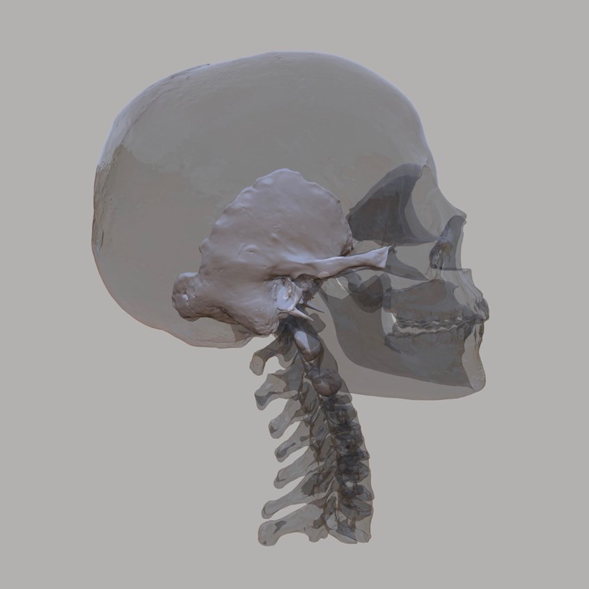 medical illustration of 3D skull and temporal bone created and optimized for a VR mastoidectomy application in the HoloLens.
Created for Medtronic