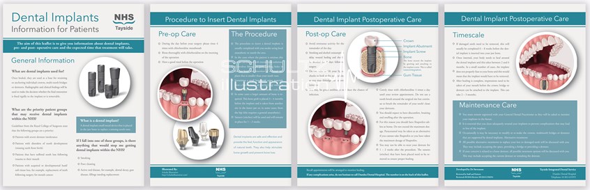 medical illustration of Dental Implant Pamphlet created for the National Health Service in Dundee, Scotland
Created using Photoshop & InDesign