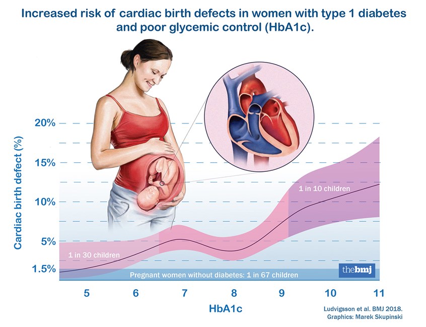 medical illustration of Press release illustration (for website and social media marketing channels) for an scientific publication on Increased risk of cardiac birth defects with woman with type 1 diabetes and poor glycemic control. Client: Karolinska Institute (Sweden)