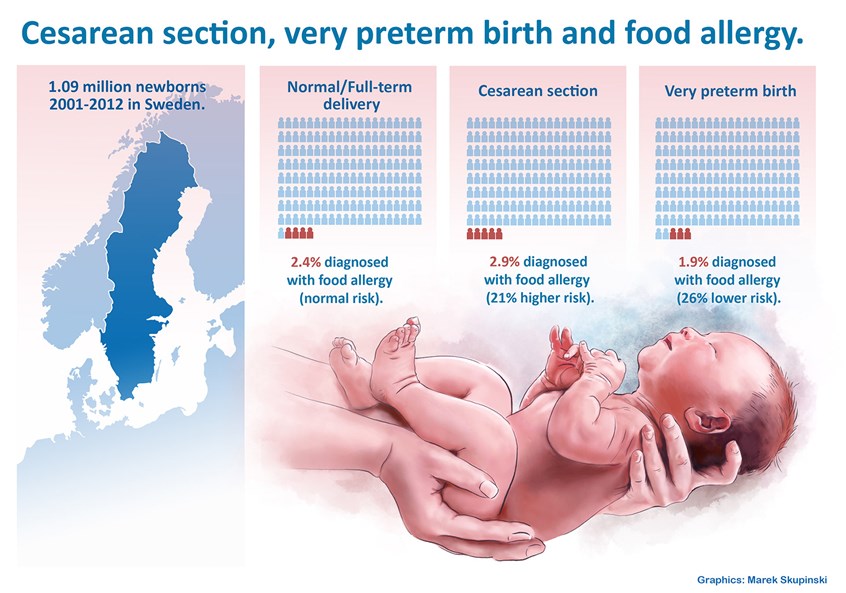 medical illustration of Press release illustration (for website and social media marketing channels) for a scientific publication on Caesarian section, very preterm birth and food allergy. Client: Karolinska Institute (Sweden)