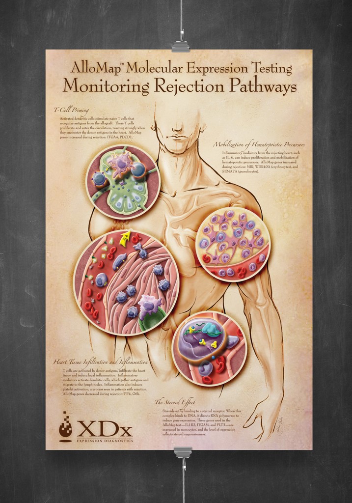 medical illustration of The AlloMap gene expression test helps physicians identify the absence of heart rejection in transplant patients through a proprietary analysis of their blood. The processes in heart rejection are shown at the cellular and molecular level to indicate the rejection pathways that the AlloMap Test detects. Combining a classical figure drawing with colorful and expressive detail sections, this illustration was designed to be not only informative, but displayed as a poster.